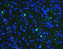 Invitrogen Tyrosine Hydroxylase Polyclonal Antibody 100 &mu;g | Buy Online | Invitrogen&trade; | Fisher Scientific