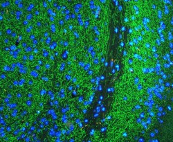 Invitrogen Tyrosine Hydroxylase Polyclonal Antibody 100 &mu;g | Buy Online | Invitrogen&trade; | Fisher Scientific