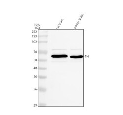 Invitrogen Tyrosine Hydroxylase Polyclonal Antibody 100 &mu;g | Buy Online | Invitrogen&trade; | Fisher Scientific