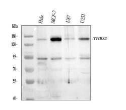 Invitrogen Thrombospondin 2 Polyclonal Antibody 100 &mu;g; Unconjugated:Antibodies,