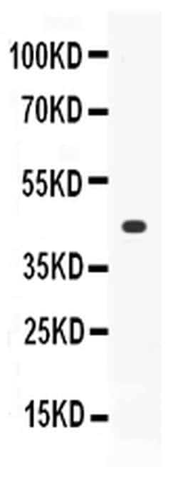 Invitrogen Thrombopoietin Polyclonal Antibody 100 &mu;g; Unconjugated:Antibodies,