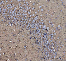 Invitrogen CD90 Polyclonal Antibody 100 &mu;g; Unconjugated:Antibodies,