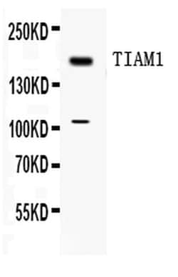 Invitrogen TIAM1 Polyclonal Antibody 100 &mu;g | Buy Online | Invitrogen&trade; | Fisher Scientific