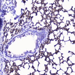 Invitrogen Talin 1 Polyclonal Antibody 100 &mu;g; Unconjugated:Antibodies,
