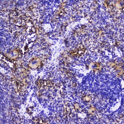 Invitrogen Talin 1 Polyclonal Antibody 100 &mu;g; Unconjugated:Antibodies,