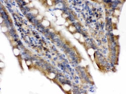 Invitrogen Talin 2 Polyclonal Antibody 100 &mu;g | Buy Online | Invitrogen&trade; | Fisher Scientific