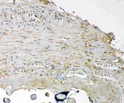 Tenascin C Rabbit anti-Human,Mouse,Rat, Polyclonal, Invitrogen 100 &mu;g