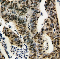 Invitrogen TNFAIP1 Polyclonal Antibody 100 &mu;g; Unconjugated:Antibodies,