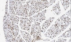 Invitrogen TNFAIP1 Polyclonal Antibody 100 &mu;g; Unconjugated:Antibodies,