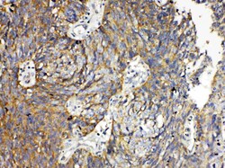 Invitrogen RANK (CD265) Polyclonal Antibody 100 &mu;g | Buy Online | Invitrogen&trade; | Fisher Scientific