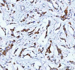 TACI Polyclonal Antibody:Antibodies, Polyclonal
