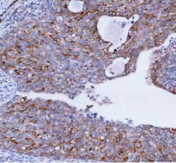 TACI Polyclonal Antibody:Antibodies, Polyclonal
