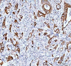 TACI Polyclonal Antibody:Antibodies, Polyclonal
