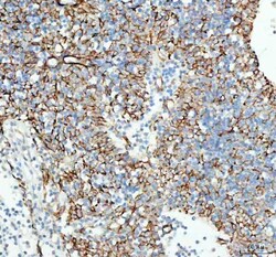 TACI Polyclonal Antibody:Antibodies, Polyclonal