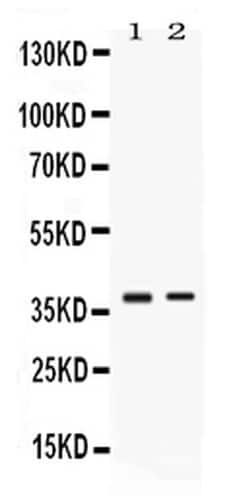 Invitrogen TNFRSF14 (HVEM) Polyclonal Antibody 100 &mu;g; Unconjugated:Antibodies,