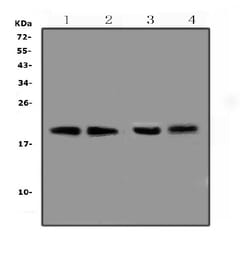 Invitrogen BCMA Polyclonal Antibody 100 &mu;g | Buy Online | Invitrogen&trade; | Fisher Scientific