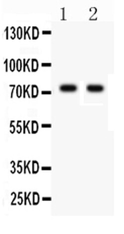 Invitrogen TNFR2 Polyclonal Antibody 100 &mu;g; Unconjugated:Anticuerpos