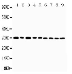 Invitrogen OX40 (CD134) Polyclonal Antibody 100 &mu;g | Buy Online | Invitrogen&trade; | Fisher Scientific