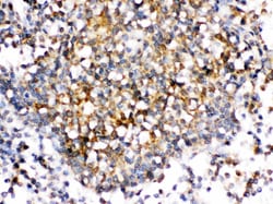 Invitrogen CD153 Polyclonal Antibody 100 &mu;g; Unconjugated:Antibodies,