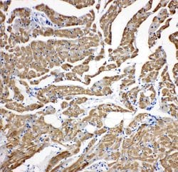 Invitrogen Cardiac Troponin C Polyclonal Antibody 100 &mu;g; Unconjugated:Antibodies,