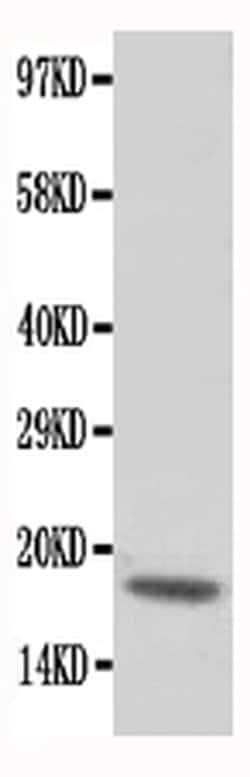 Invitrogen Cardiac Troponin C Polyclonal Antibody 100 &mu;g; Unconjugated:Antibodies,