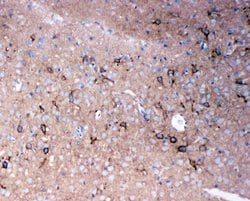 Invitrogen Tenascin R Polyclonal Antibody 100 &mu;g; Unconjugated:Antibodies,
