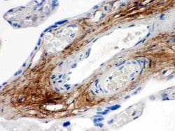 Invitrogen TNXB Polyclonal Antibody 100 &mu;g; Unconjugated:Antibodies,