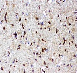 p73 Polyclonal Antibody:Antibodies, Polyclonal