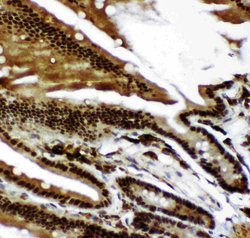 p73 Polyclonal Antibody:Antibodies, Polyclonal