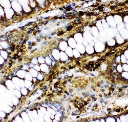 p73 Polyclonal Antibody:Antibodies, Polyclonal