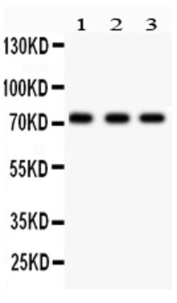 p73 Polyclonal Antibody:Antibodies, Polyclonal