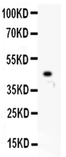 p73 Polyclonal Antibody:Antibodies, Polyclonal