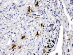 Invitrogen Tryptase Polyclonal Antibody 100 &mu;g; Unconjugated:Antibodies,