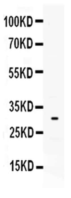 Invitrogen Tryptase Polyclonal Antibody 100 &mu;g; Unconjugated:Antibodies,