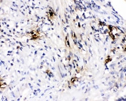 Invitrogen Tryptase Polyclonal Antibody 100 &mu;g; Unconjugated:Antibodies,