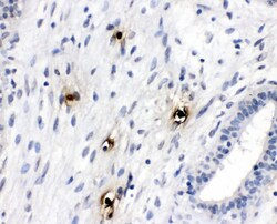Invitrogen Tryptase Polyclonal Antibody 100 &mu;g; Unconjugated:Antibodies,