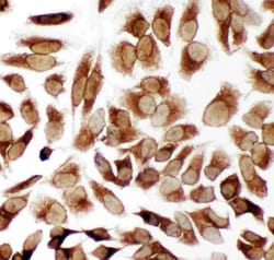 TRAM1 Polyclonal Antibody:Antibodies, Polyclonal