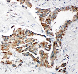 TRAM1 Polyclonal Antibody:Antibodies, Polyclonal