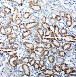 TRAM1 Polyclonal Antibody:Antibodies, Polyclonal