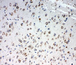 TRAM1 Polyclonal Antibody:Antibodies, Polyclonal