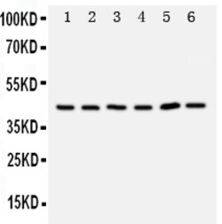 TRAM1 Polyclonal Antibody:Antibodies, Polyclonal