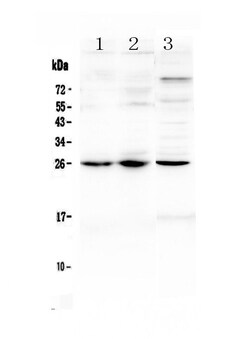 TREM1 Polyclonal Antibody:Antibodies, Polyclonal