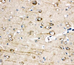 Invitrogen TRPC3 Polyclonal Antibody 100 &mu;g; Unconjugated:Antibodies,