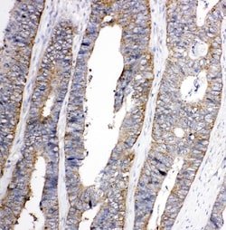 Invitrogen TRPC3 Polyclonal Antibody 100 &mu;g; Unconjugated:Antibodies,