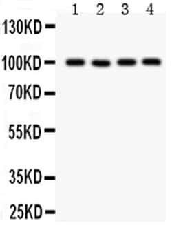 Invitrogen TRPC7 Polyclonal Antibody 100 &mu;g; Unconjugated:Antibodies,