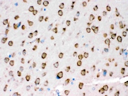 Invitrogen TRPM5 Polyclonal Antibody 100 &mu;g; Unconjugated:Antibodies,