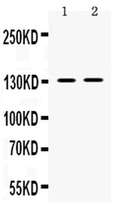 Invitrogen TRPM5 Polyclonal Antibody 100 &mu;g; Unconjugated:Antibodies,