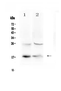 Invitrogen TSLP Polyclonal Antibody 100 &mu;g; Unconjugated:Antibodies,