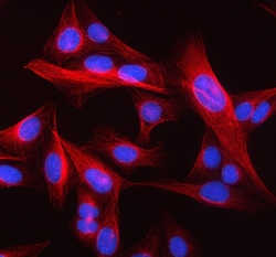 Invitrogen™ beta-5 Tubulin Polyclonal Antibody