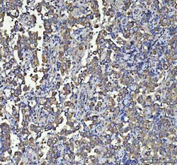 Invitrogen beta-5 Tubulin Polyclonal Antibody 100 &mu;g; Unconjugated:Antibodies,